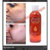 recovery oil Osiris X 1 Bottle Recovery Oil. Osiris Hydrates,