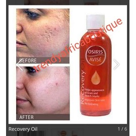 recovery oil Osiris X 1 Bottle Recovery Oil. Osiris Hydrates, Help Against Scars & Stretch Marks👌👌