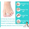 Byehambuni Hammer Toe Straightener, 6 Pack Hammer Toe Corrector for