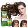 Lo Aceite De Romero Para El Crecimiento Del Cabello, (30ml)