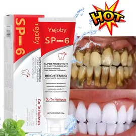 Yejoby (New) 2025 SP-6 Ultra Whitening Toothpaste,Deep Cleaning Care Fresh Breath Super Probiotic-6 Toothpaste with Probiotic Oalance Oral Microbiot. - Specification: SP6 2Pcs(Best Choice!!!)