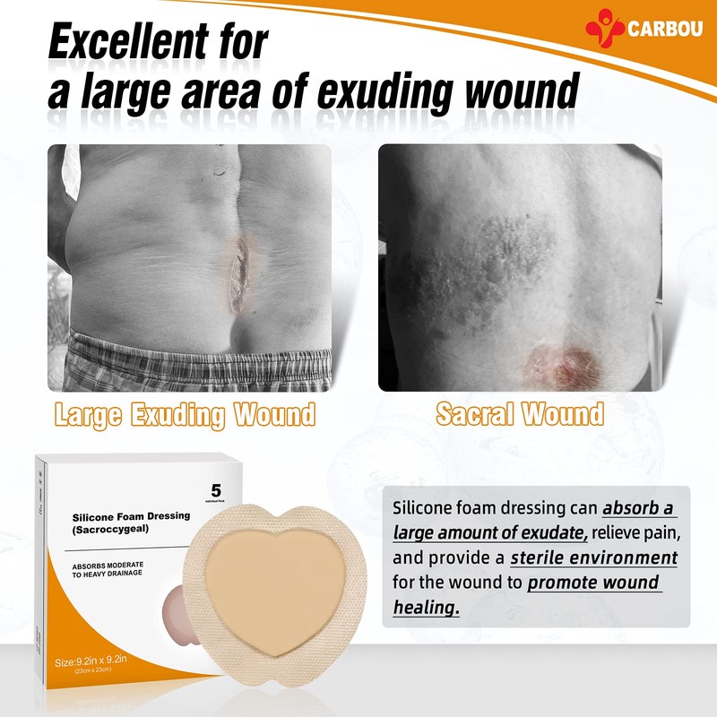 Carbou Silicone Sacrum Foam Dressing, 9''x9''(23cm x23cm) Bordered Adhesive Sacral