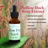 Best Botanicals Yellow Dock Root Extract 1 oz.