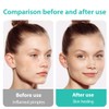 EIROVYA Pimple Patches Pickel Patch Hydrokolloid Akne Pimple Patch mit