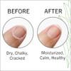 Aceite para cutículas para uñas: humectante para cutículas, fortalecedor de