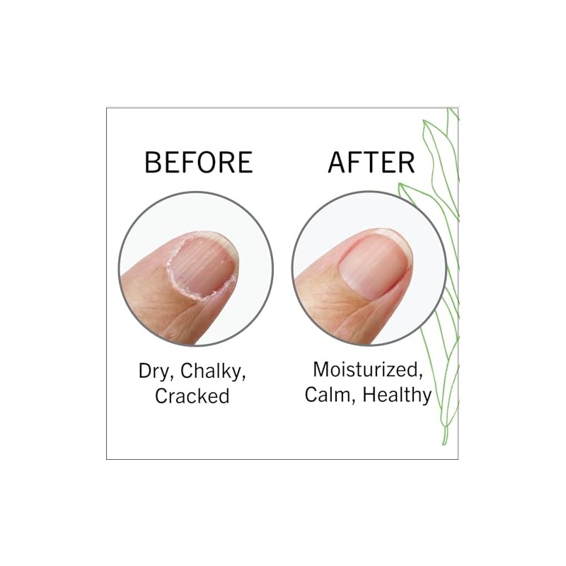 Aceite para cutículas para uñas: humectante para cutículas, fortalecedor de