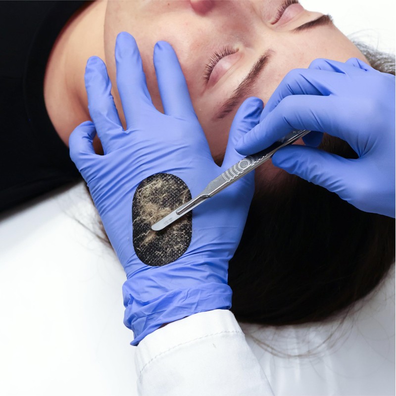 Dermapad® for Dermaplaning (100 Pack)