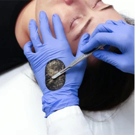 Dermapad® for Dermaplaning (100 Pack)