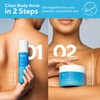 Murad Acne Body Duo Savings Bundle – Exfoliating Cleanser &