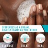 Limpiador Crema Espumosa Acné Cerave Jabón Facial Tratamiento Peróxido Benzoilo