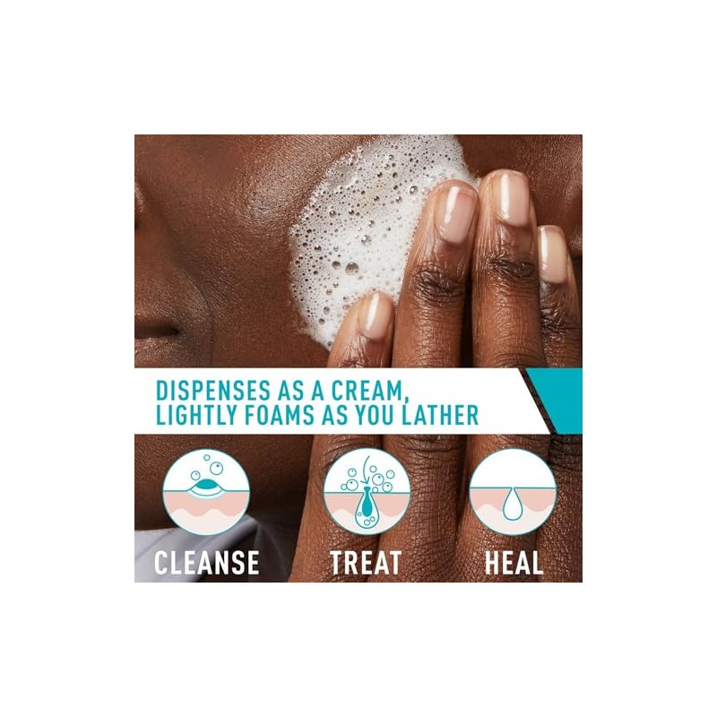 Limpiador Crema Espumosa Acné Cerave Jabón Facial Tratamiento Peróxido Benzoilo
