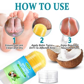 CLERVUN 60% Urea Cream Stick with 2% Salicylic Acid, Anti-Cracking Foot & Hand Cream Moisturizer for Dry Cracked Heel Feet, Knee, Elbow, Foot Balm Stick for Callus Remover & Dead Skin Softener (1)