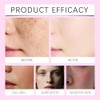 Arbutin Cream, Arbutin 7% + Tranexamic Acid 4% Cream, Lightweight