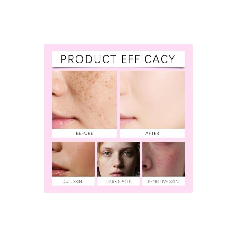 Arbutin Cream, Arbutin 7% + Tranexamic Acid 4% Cream, Lightweight