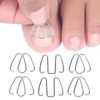 Ingrown Nail Corrector Wire Fixer for Ingrown Toenails Professional Iron