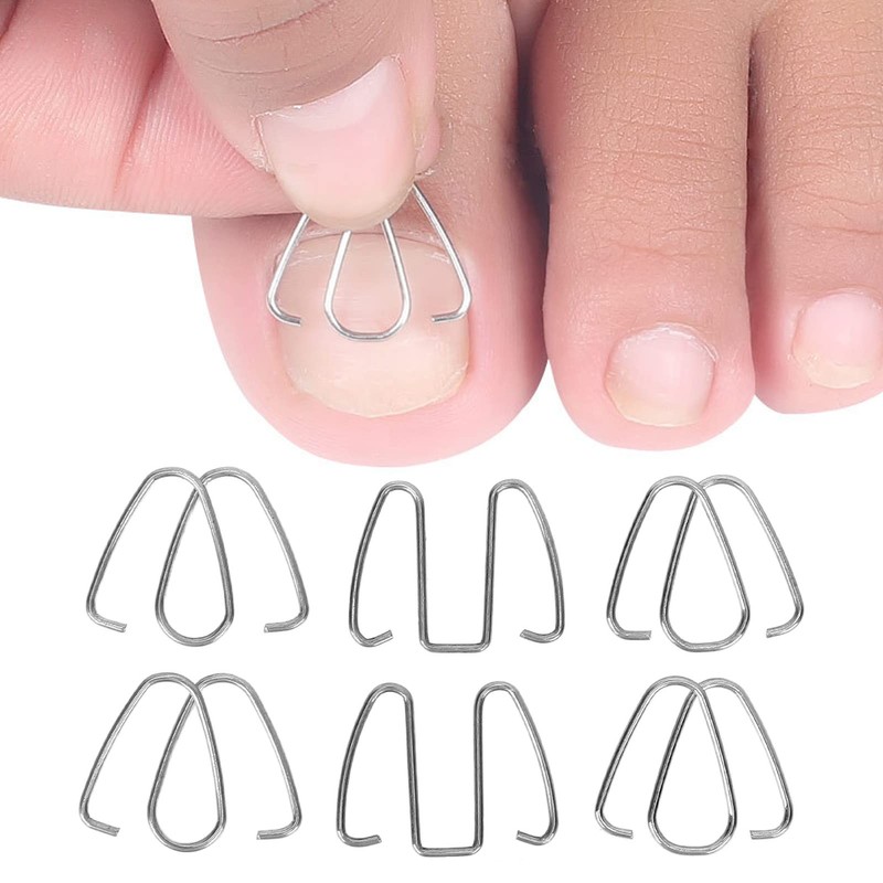 Ingrown Nail Corrector Wire Fixer for Ingrown Toenails Professional Iron