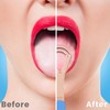 Zivacate Tongue Scraper with Handle, Tongue Scraper with Double Scraper