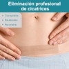 Cinta de Silicona Médica Avanzada para Eliminar Cicatrices, (Rollo de
