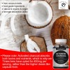 Tinies bers Activated Charcoal Gummies Sugar Free, 400Mg Charcoal Supplements