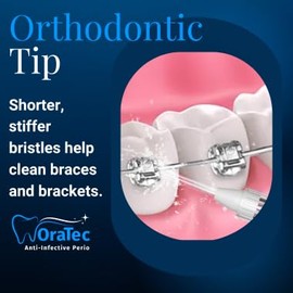 Viajet Ozone Orthodontic Replacement Tip (Colors May Vary)