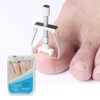 Ingrown Toenail Tool, Toenail Removal Clippers, Nail Treatment Ingrown Toenail