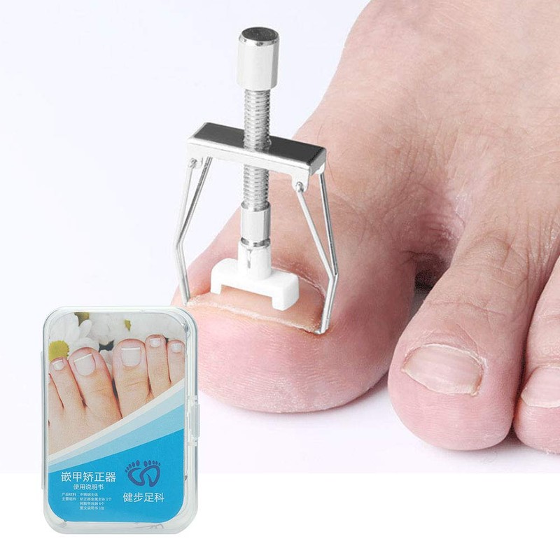 Ingrown Toenail Tool, Toenail Removal Clippers, Nail Treatment Ingrown Toenail