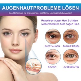Anti-Aging Augenpads - Augenmaske mit Natürlichem Meereskollagen, Hyaluronsäure, Augenpads gegen Tränensäcke, Augenringe, Falten, Puffiness, Augen Pads für Teenager Mädchen, Under Eye Patches