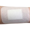 Nissin Medical Equipment Elmo Scratch Pads Size S, Pack of