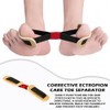 1 Piece Big Toe Training Band Hallux Valgus Band Corrector