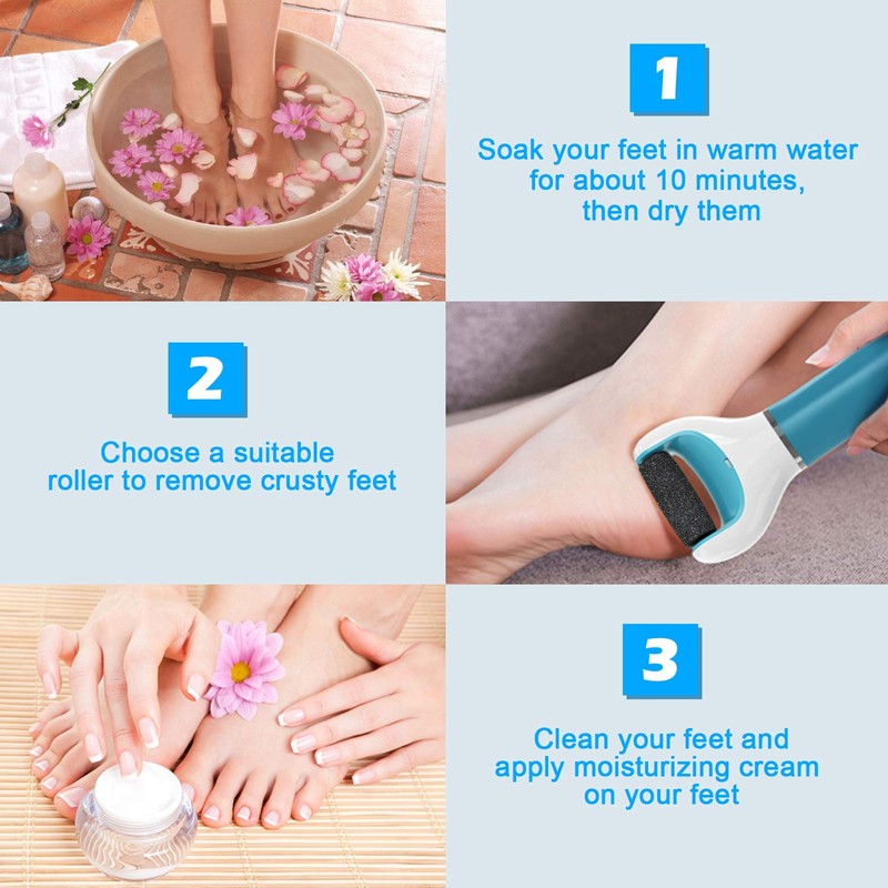 Jorest [10/20 Pcs] Replacement Rollers Refills Compatible with Scholl Velvet