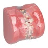 Demonstration Orthodontics Dental Model Disassembled Resin Teeth Model for Teaching