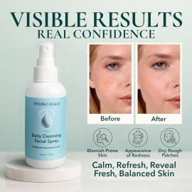 NOVEHA Hypochlorous Acid Spray for Face 4oz – Pure Hypochlorous Acid Spray Cleaner, Dai