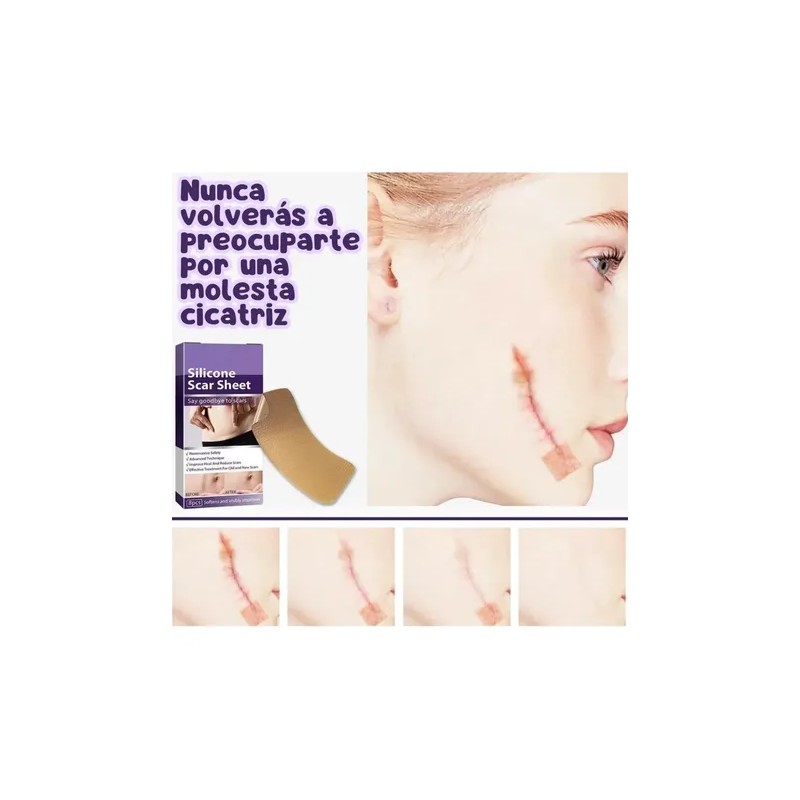 8 Parches Silicona Reutilizables Cicatrices Grado Medico F