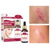 Aichun Beauty Scar Removal Serum Pimples Stretch Marks Face Whitening