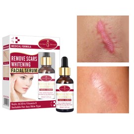 Aichun Beauty Scar Removal Serum Pimples Stretch Marks Face Whitening Moisturizing Body 30ml