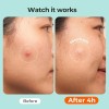 Yves Rocher Anti Age Global Micro Sérum Lumonosidad Absoluta, Suaviza