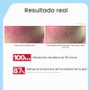 Illiyoon- CUIDADO HIPOALERGÉNICO Y DE ALTA HIDRATACIÓN Alivia cómodamente la