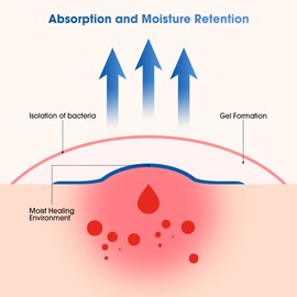 Hydrocolloid Plasters Large, ourmed Hydrocolloid Dressing 5 cm x 10 cm Extra Thin 0.3 mm, Waterproof Hydrocolloid Wound Dressing for Lightly Exuding Wounds, Bedsores, Burns, Blisters, Pack of 10