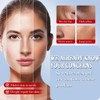 Kojic Acid Cream, Face and Body Gel, Dark Spots, Melasma,