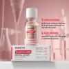 Loción Secante Antiacné Ácido Salicílico 10ml Oukeya