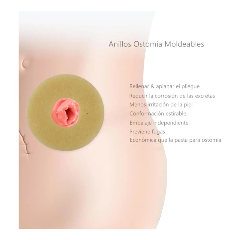 4mm Anillo Barrera Para Ostomía 50mm 10pzas