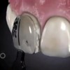 El molde de resina oral de fang1box se solidifica rápidamente