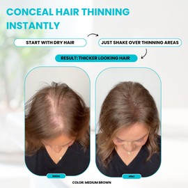 SureThik Hair Thickening Fibers (30g, Grey) - Lightweight Volume Maximizer & Building Hair Fibers for Thinning Hair