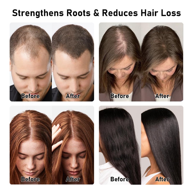 2 Pack Rosemary Batana Shampoo for Thinning Hair,11.8 Fl Oz