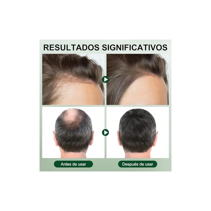 2PCS Aceite de Romero 60ml Cuidado Cabello Cejas Pestañas Barba