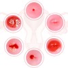 SimCoach Cervix Replicas Model, 6 Cervical Pathology Models for OB/GYN