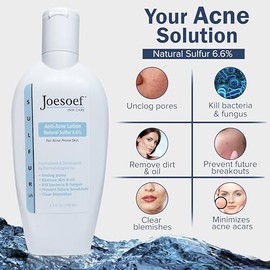 JOESOEF SKIN CARE Jabón De Azufre Para El Acné. Grado Farmacéutico. Aprobado Por Dermatólogos Para El Acné Y La Rosácea. Tratamiento De Azufre Para...