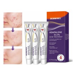 3 Gel Facial Anti-piel Acne Con Adapalene Para Piel Acnes