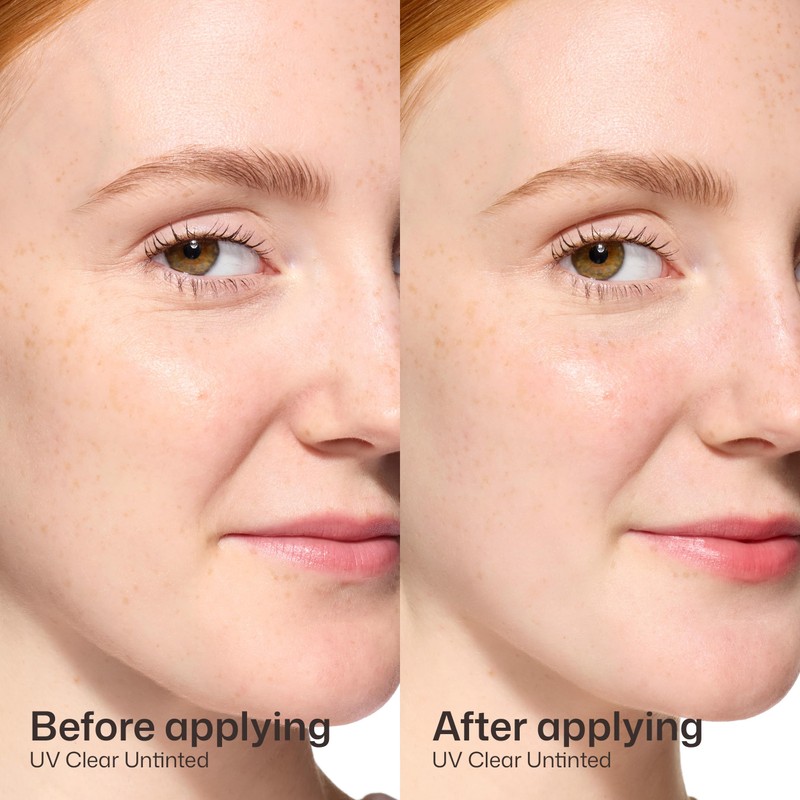 EltaMD UV Clear Face Sunscreen SPF 46, Oil-Free Sunscreen with