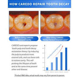 CAREDO Adults Hydroxyapatite Toothpaste for Cavity Tooth Repair, Remineralizing Toothpaste for Cavity Reversing, Tooth Filling Repair Cavity Protection Toothpaste, Enamel Repair Fluoride Free 100g